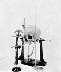 Craniometry: A human skull and measurement device from 1902.